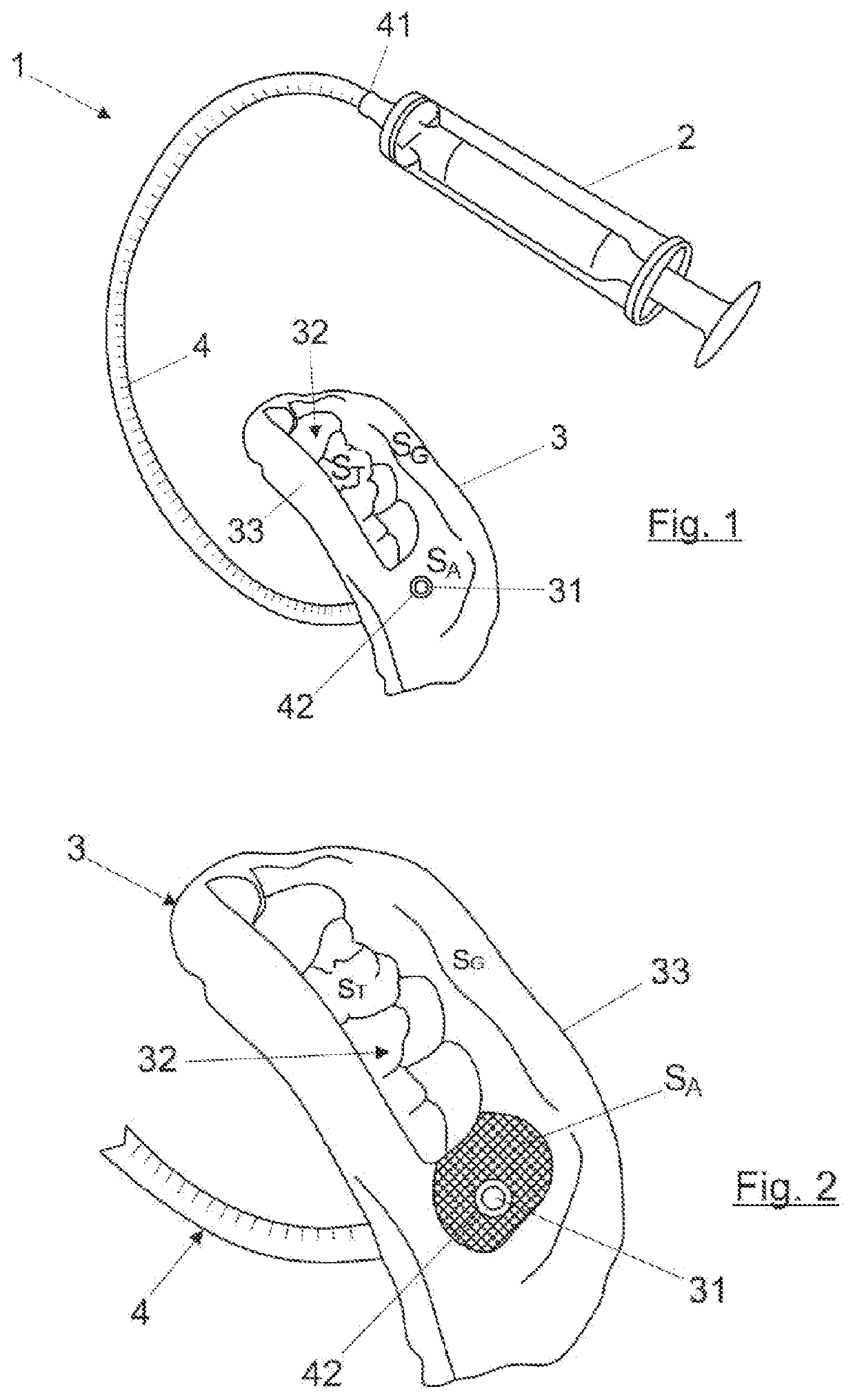 Dental device for the treatment of dental alveoli, method for manufacturing same and kit