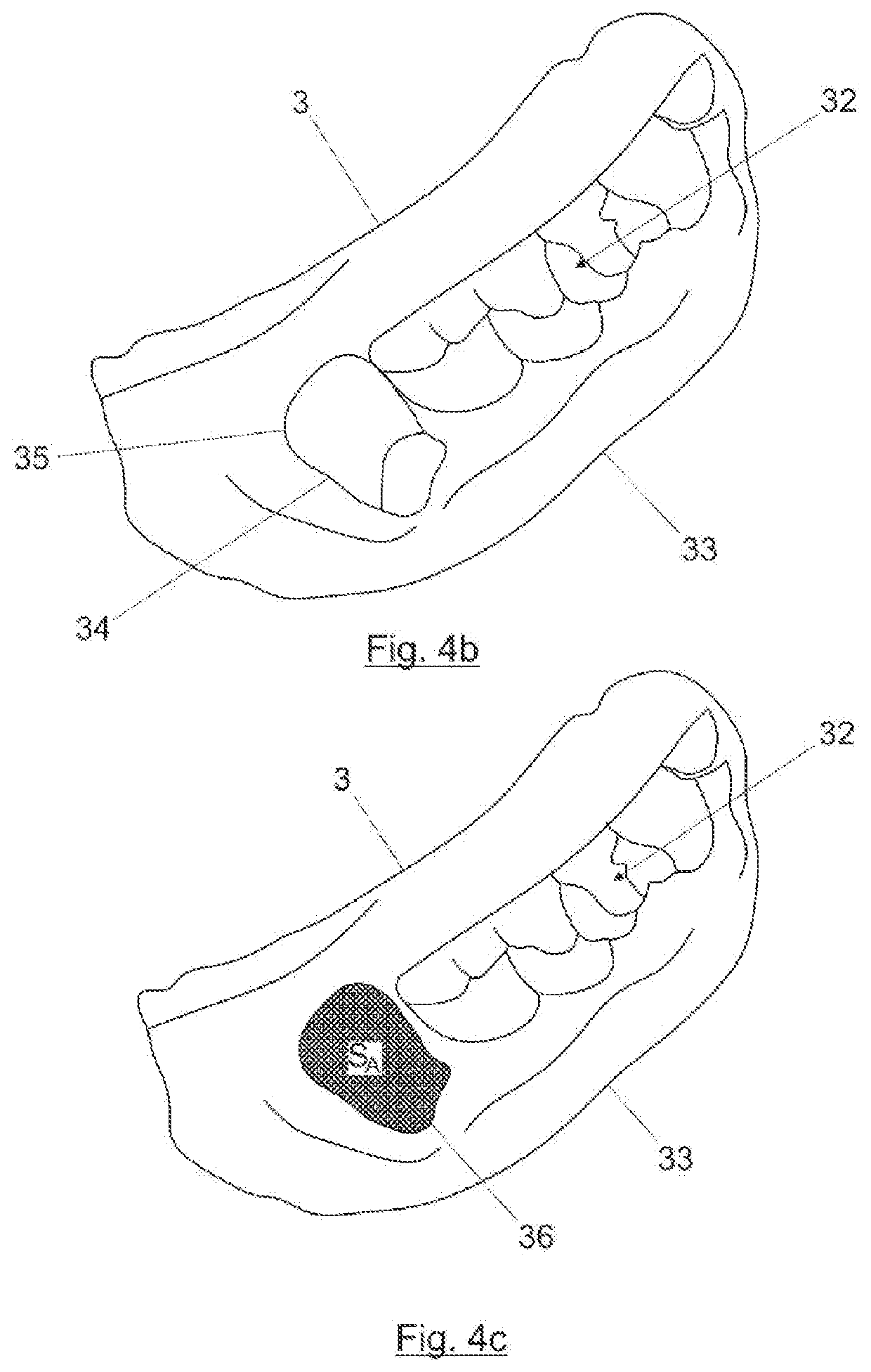 Dental device for the treatment of dental alveoli, method for manufacturing same and kit
