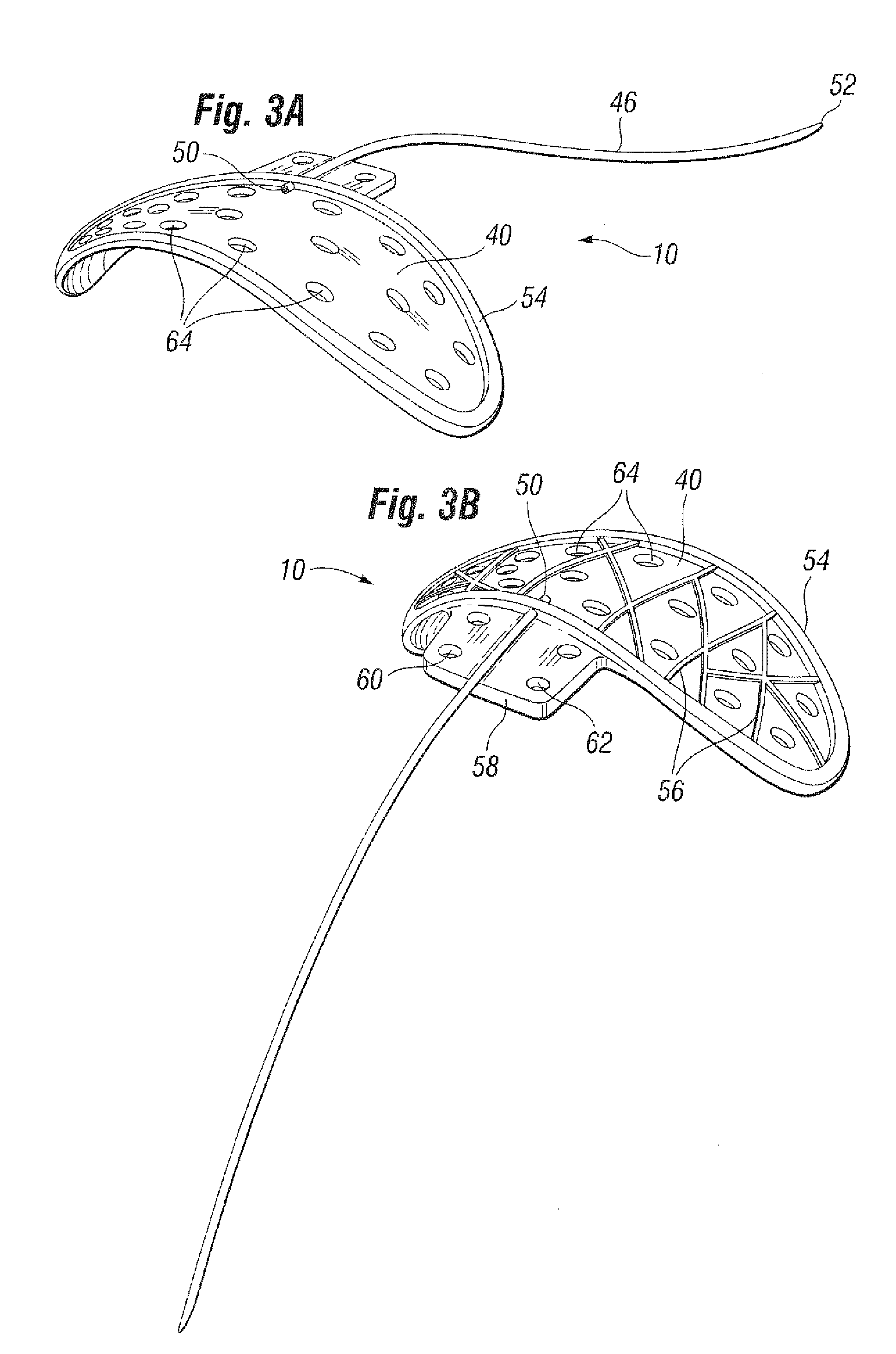 Glaucoma drainage shunts and methods of use