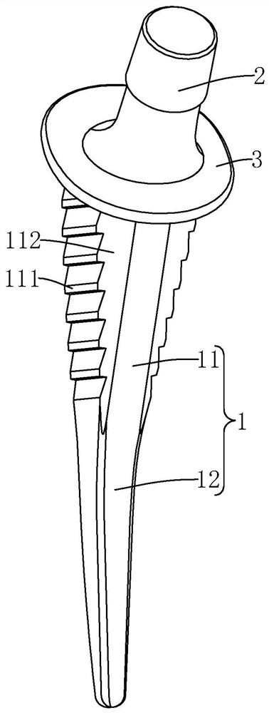 Small femoral stem prosthesis