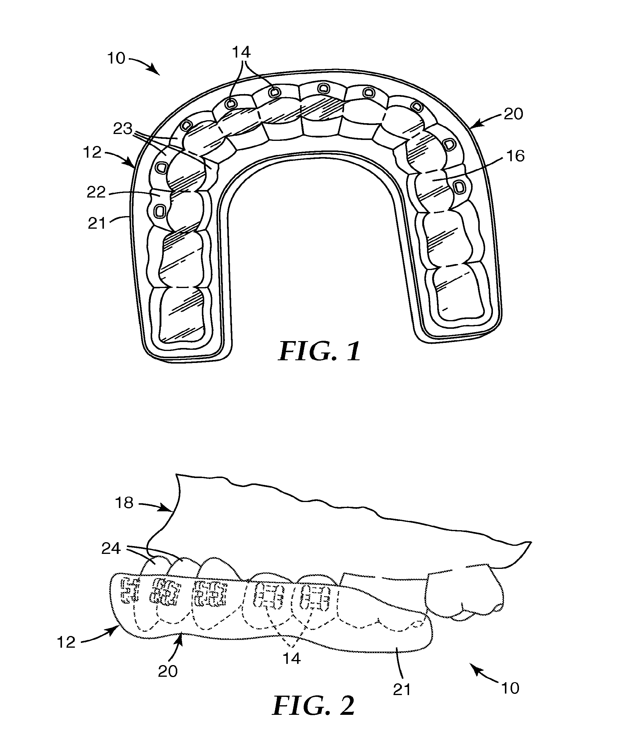 Methods and apparatus for applying dental sealant to an orthodontic patient's teeth