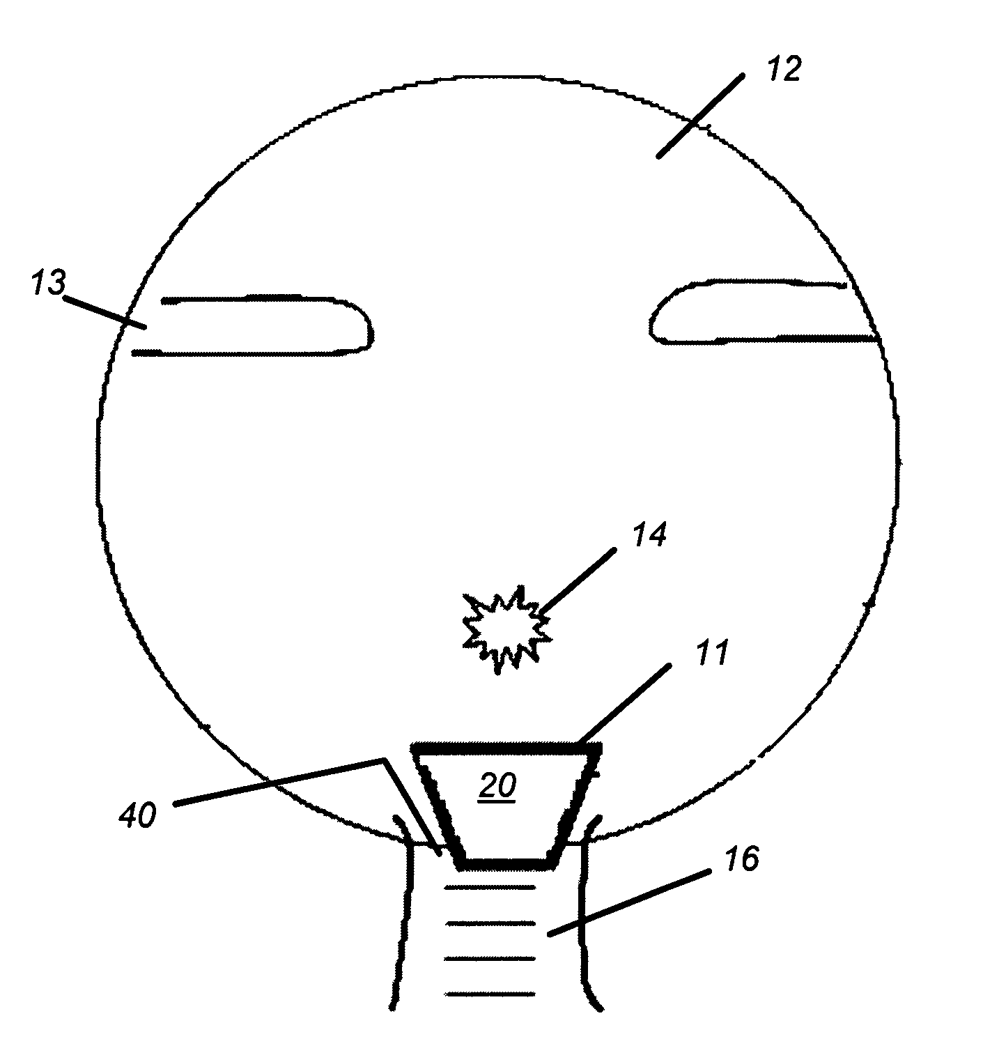 Optic nerve head implant and medication delivery system