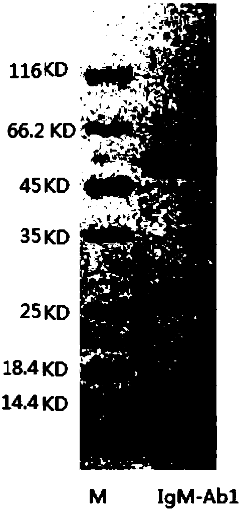 Anti-human IgM monoclonal antibody as well as hybridoma cell strain and application thereof