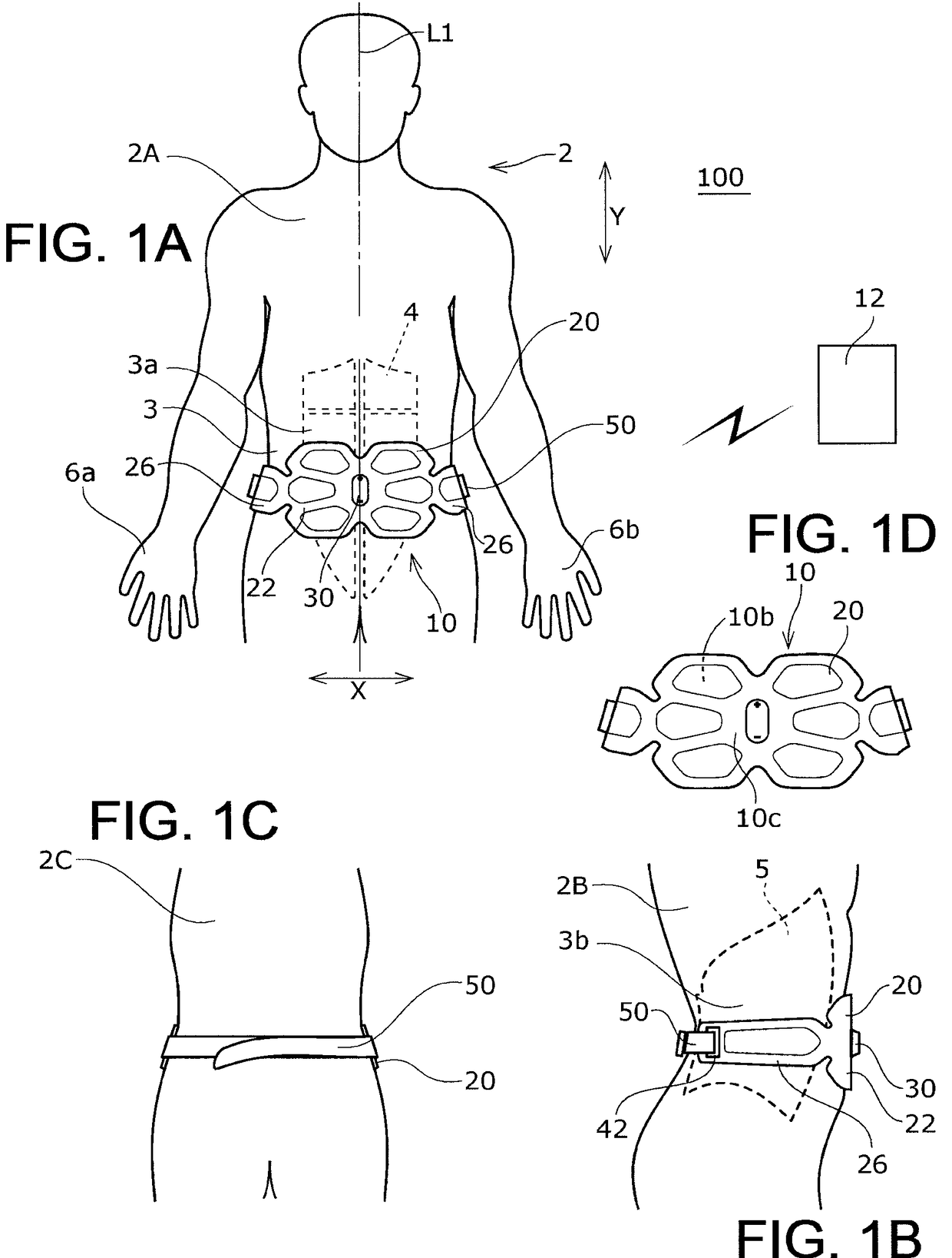 Muscle electrostimulation device