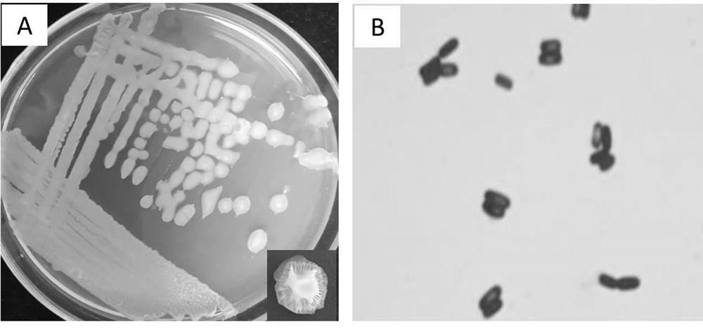 Bacillus subtilis Y2 strain and preparation method for preparing antagonistic Korla pear blackhead disease inhibitor by using bacillus subtilis Y2 strain