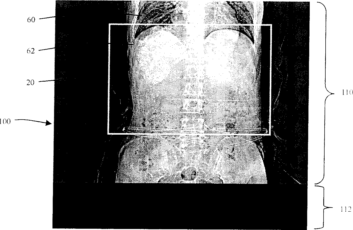 Method of automatically setting reconstructed view field along inner chest cavity border in CT locating image