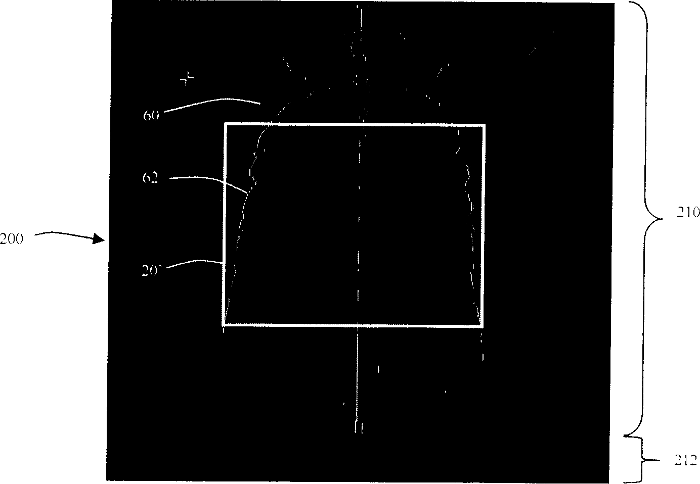 Method of automatically setting reconstructed view field along inner chest cavity border in CT locating image