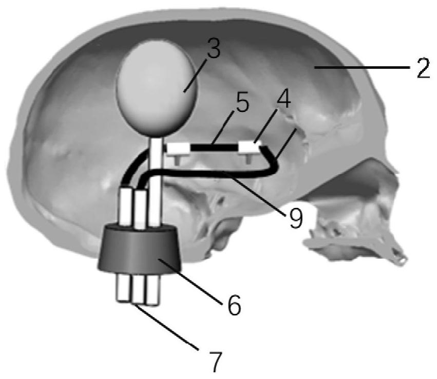 Non-invasive transcranial ultrasound blood pressure measurement device and method based on sonovue