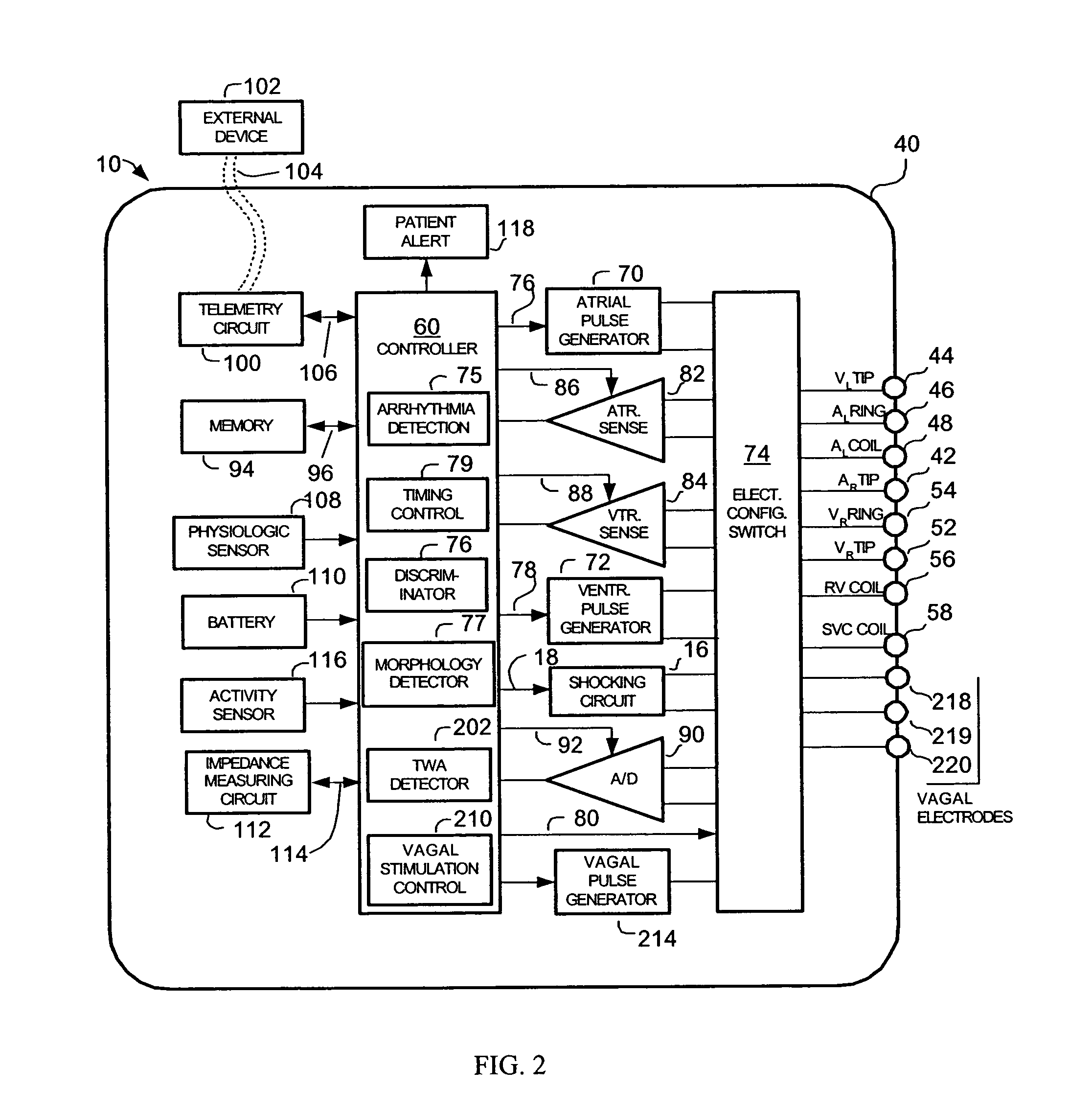 Methods and systems for detecting the presence of T-wave alternans