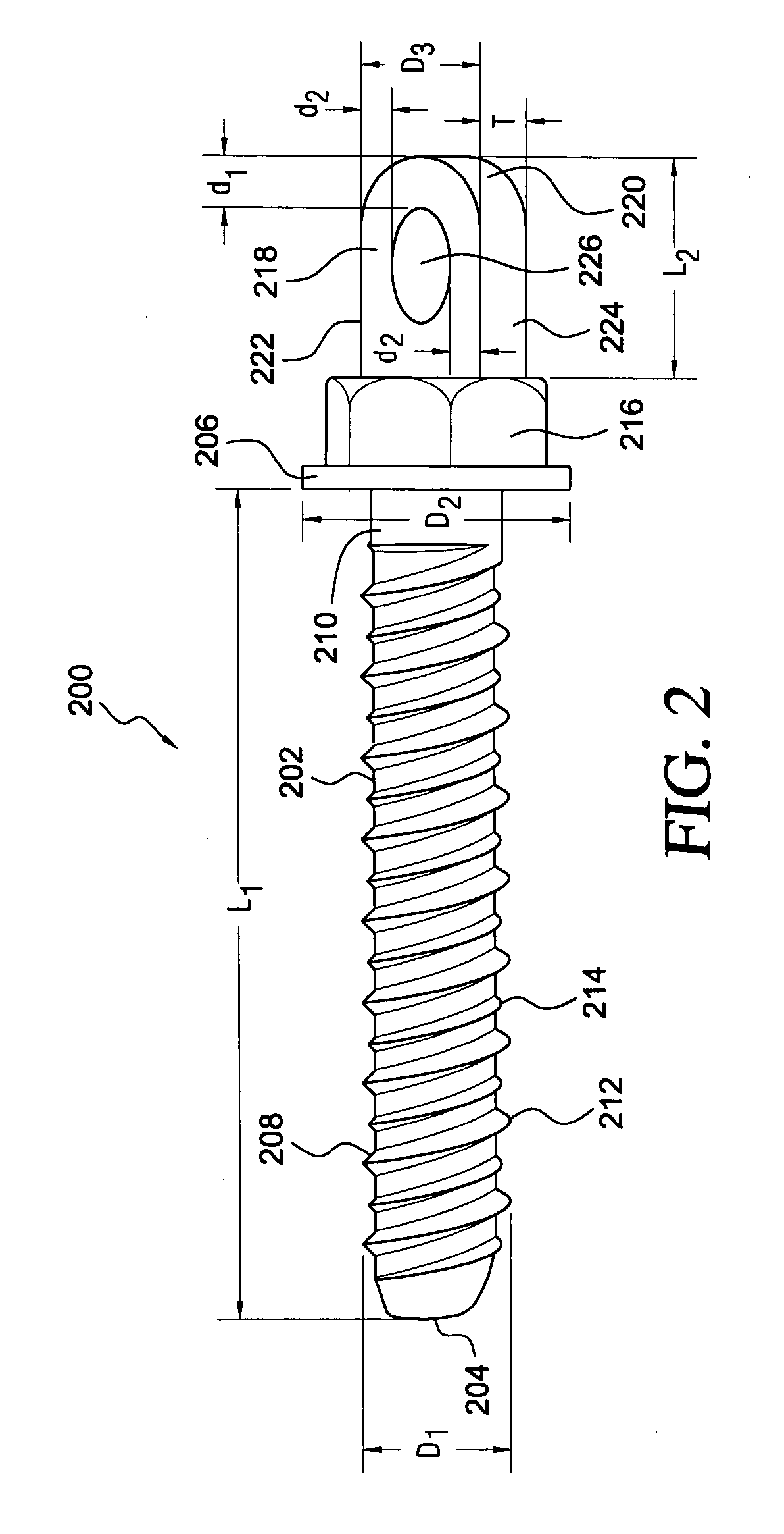 Threaded anchor having a head portion comprising a hexagonally configured drive section, and an integral projection having a transverse bore formed therein