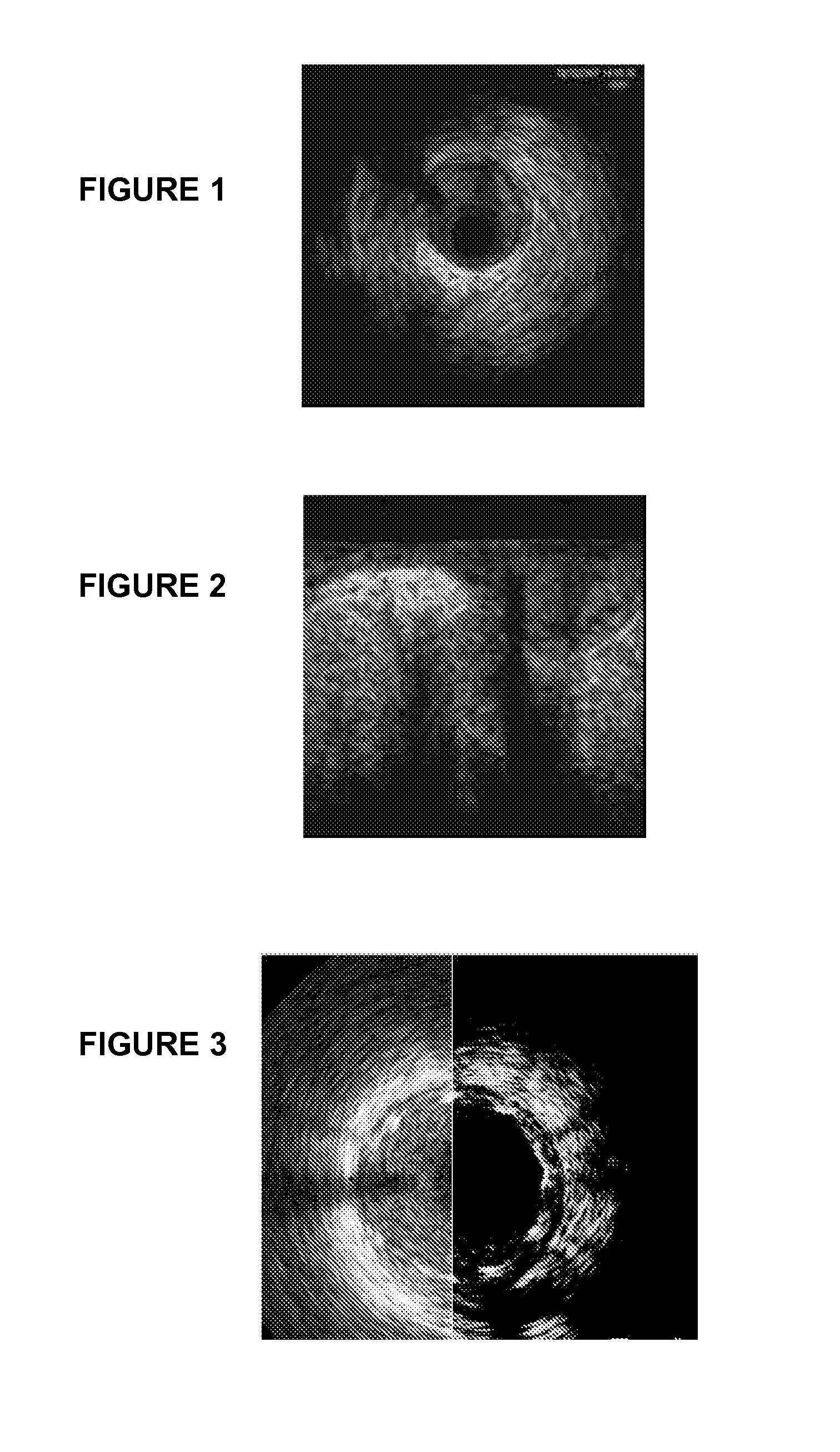 Method and system for stabilizing a series of intravascular ultrasound images and extracting vessel lumen from the images