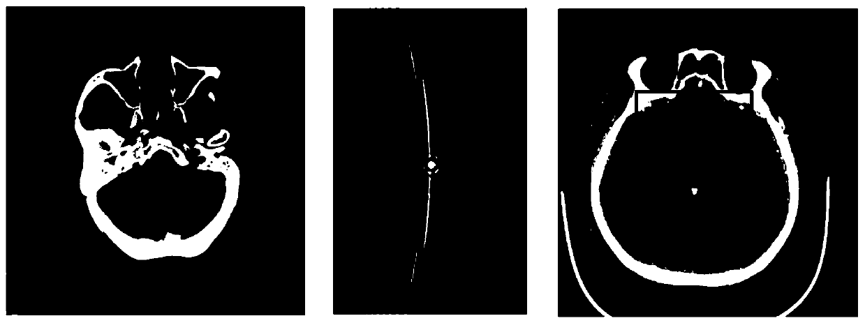 CT scan projection data artifact correction method and CT image reconstruction method