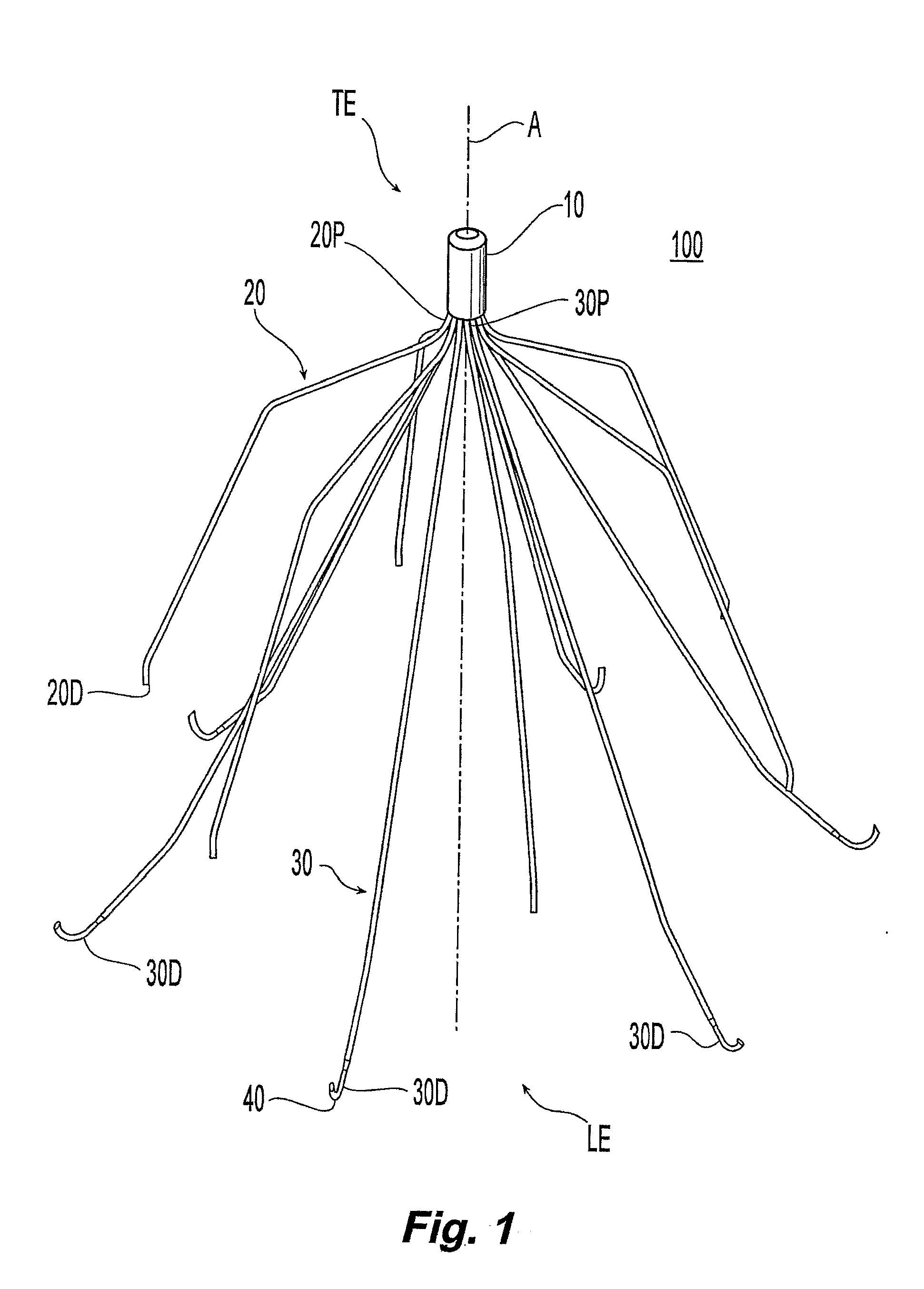 Removable blood clot filter with edge for cutting through the endothelium