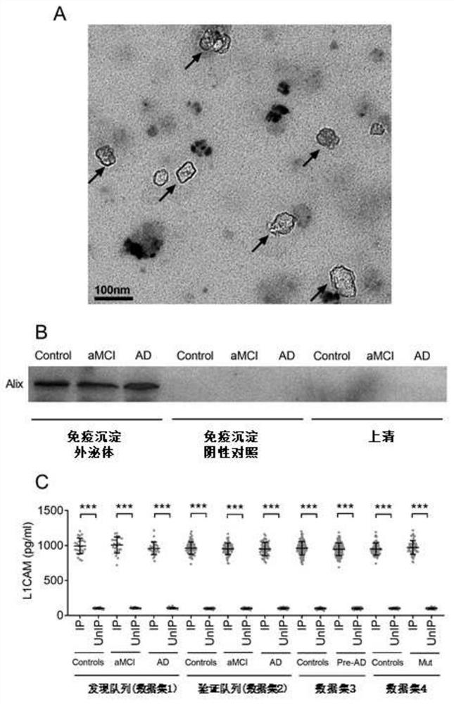 Method and kit for predicting risk of neurodegenerative diseases