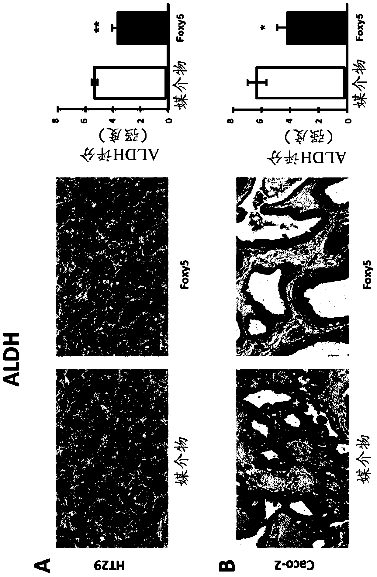 Wnt5a peptides in reduction of cancer stem cells