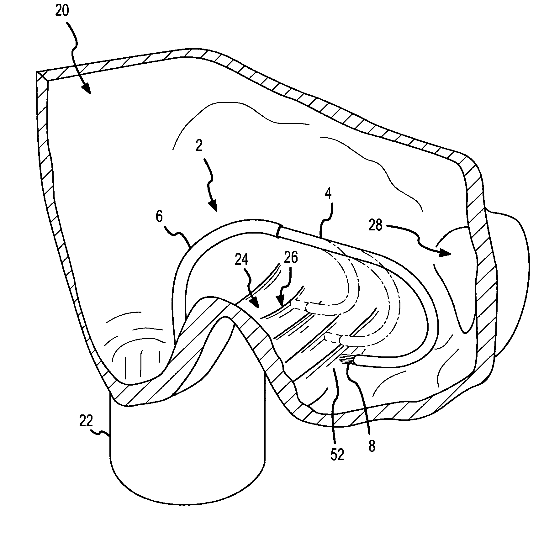 Curved ablation catheter