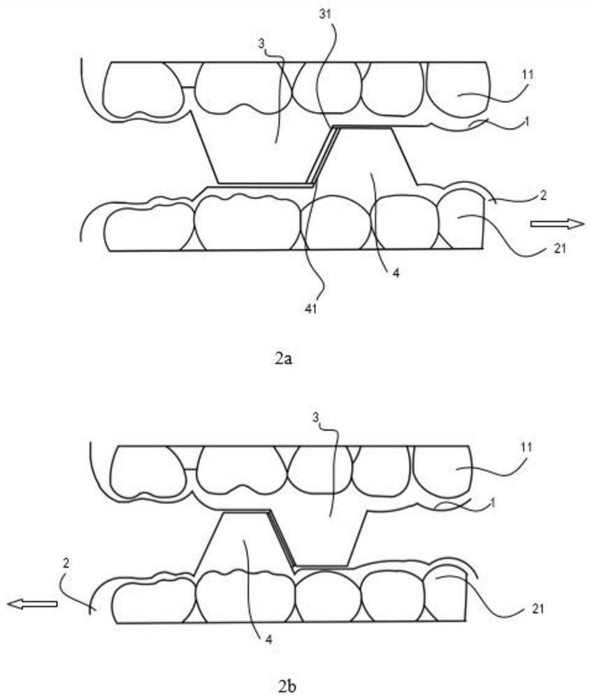 Shell-shaped dental instrument, tooth correction system and design method and preparation method of shell-shaped dental instrument