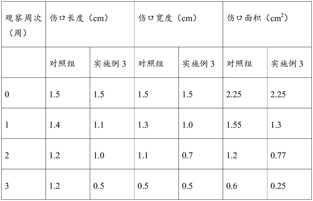 A wound dressing composite nanofibrous film and its preparation method