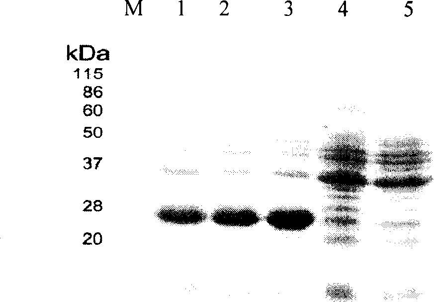 Method for expressing anthrax bacteria gamma phage lyase and its special gene
