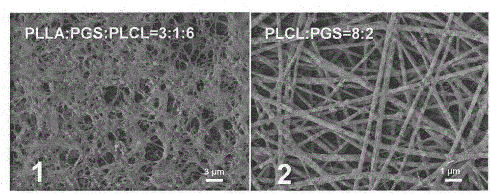 Thermally-induced phase separation nanofiber tubular stent and preparation method thereof