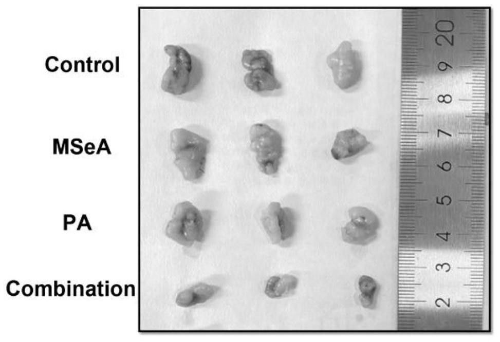 New application of palmitic acid as methylselenic acid anti-hepatoma sensitizer