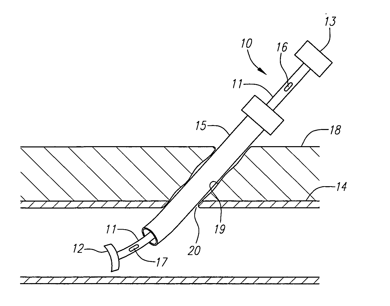 Locator and closure device and method of use