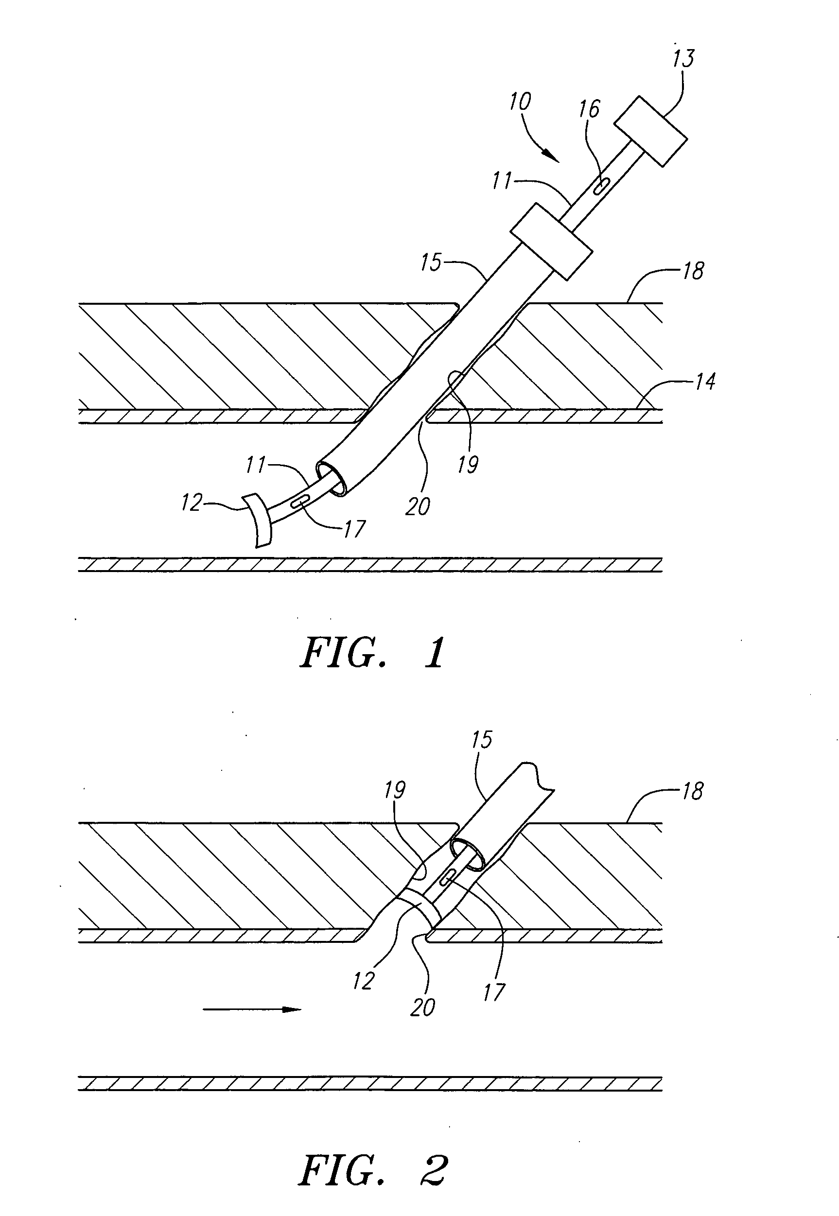 Locator and closure device and method of use