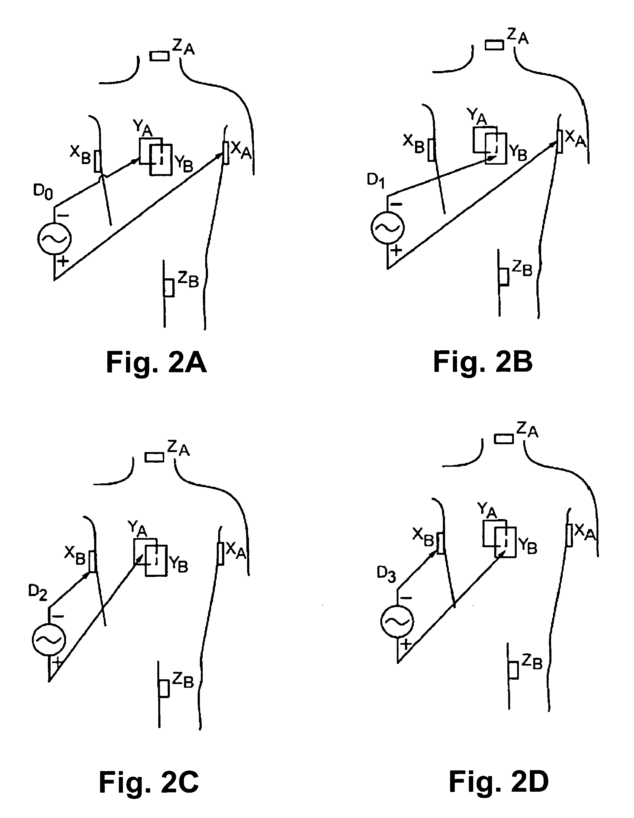 Method of scaling navigation signals to account for impedance drift in tissue