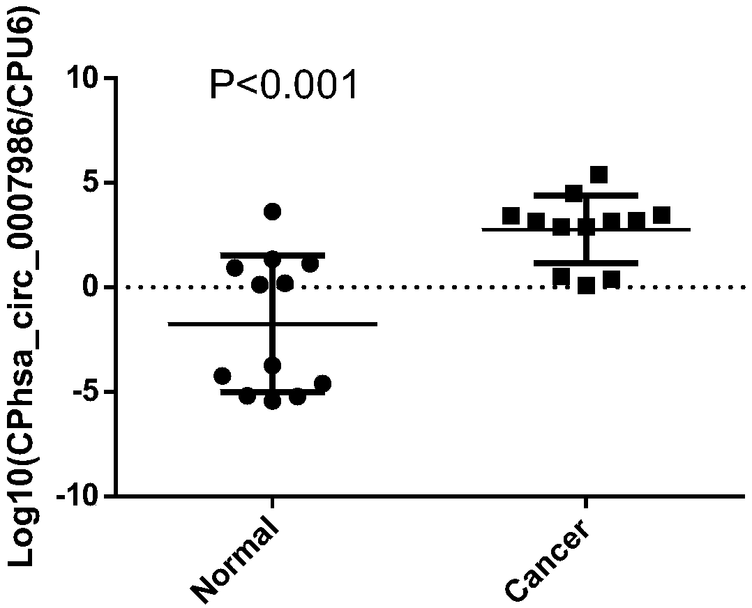 Method for detecting hsa_circ_0007986 as novel biomarker in serum of patient with esophagus cancer and application