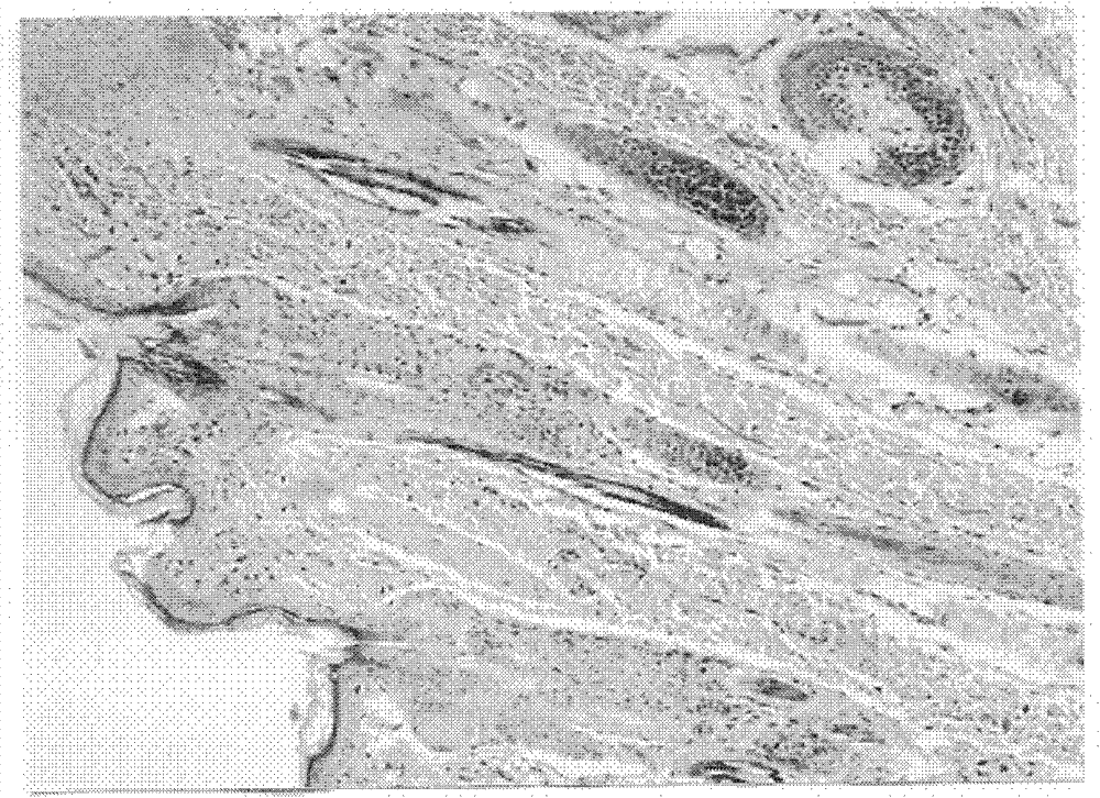 Muramidase hydrolase external sterile cream for treating skin ulcer and preparation method thereof