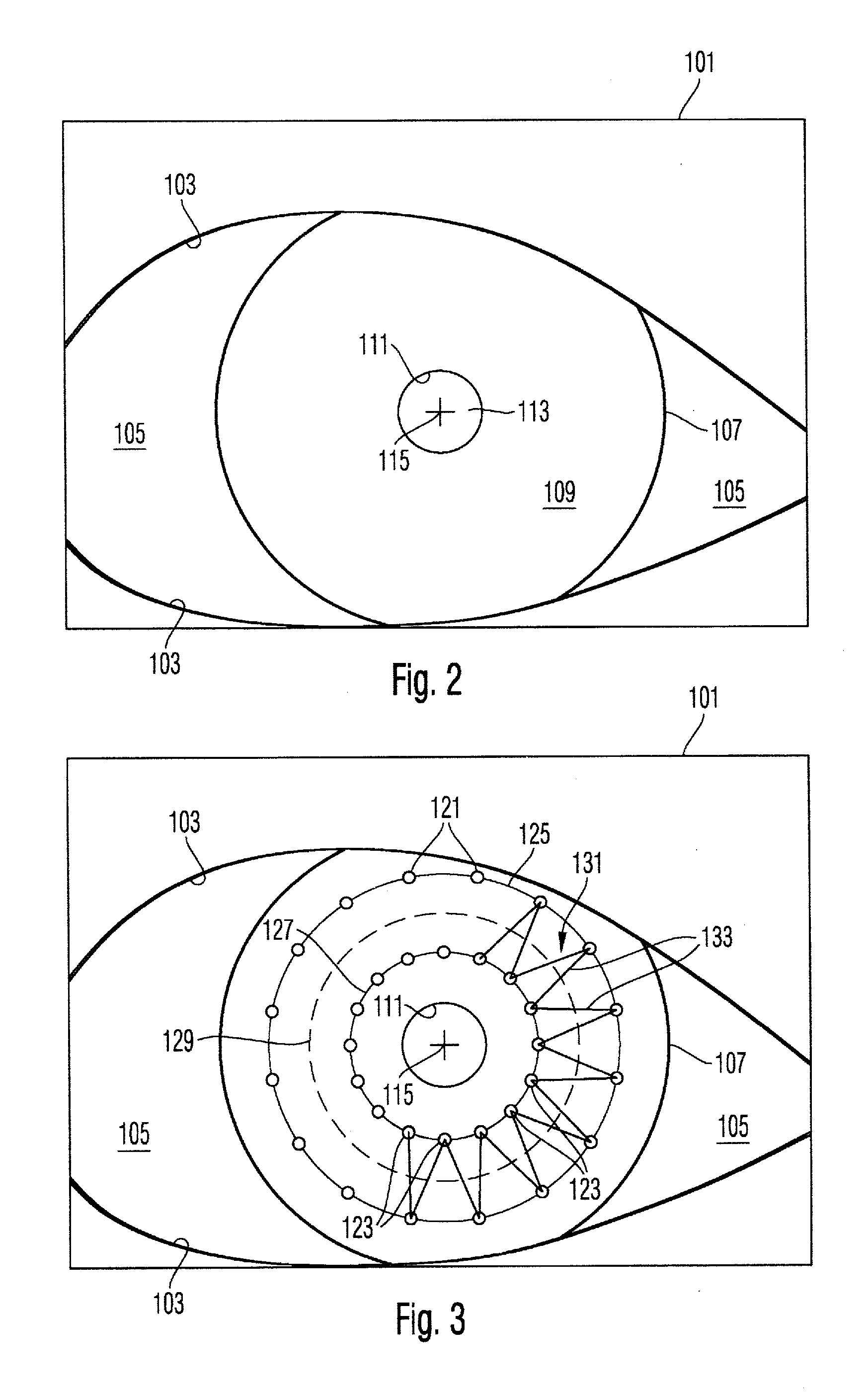 Surgical microscopy system and method for performing eye surgery