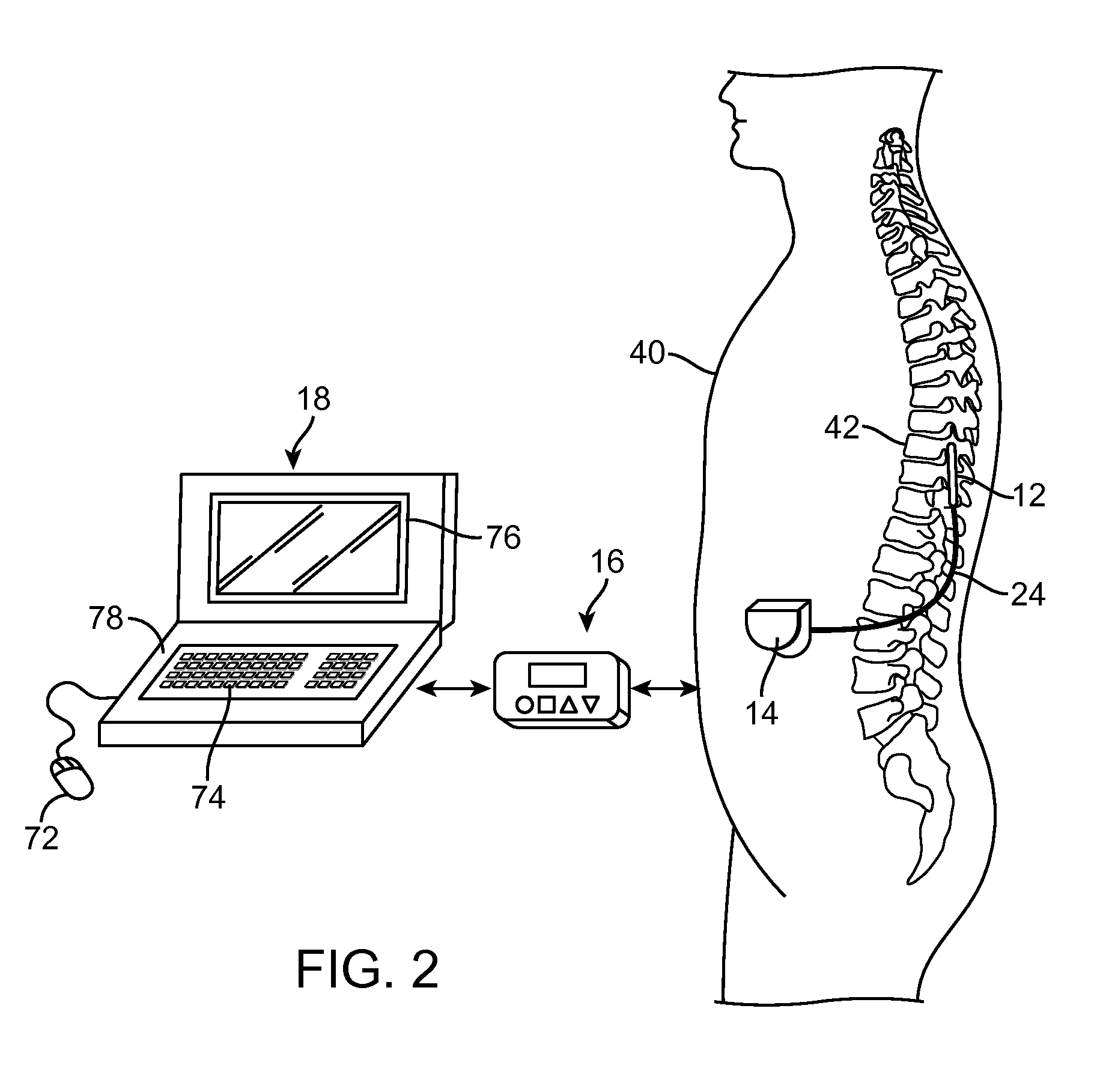 Neuromodulation system and method for transitioning between programming modes