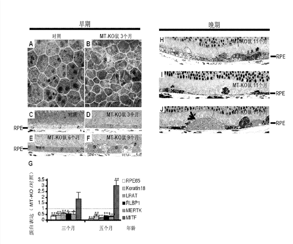 Rapamycin microemulsion injection for eyes and preparation method and application thereof