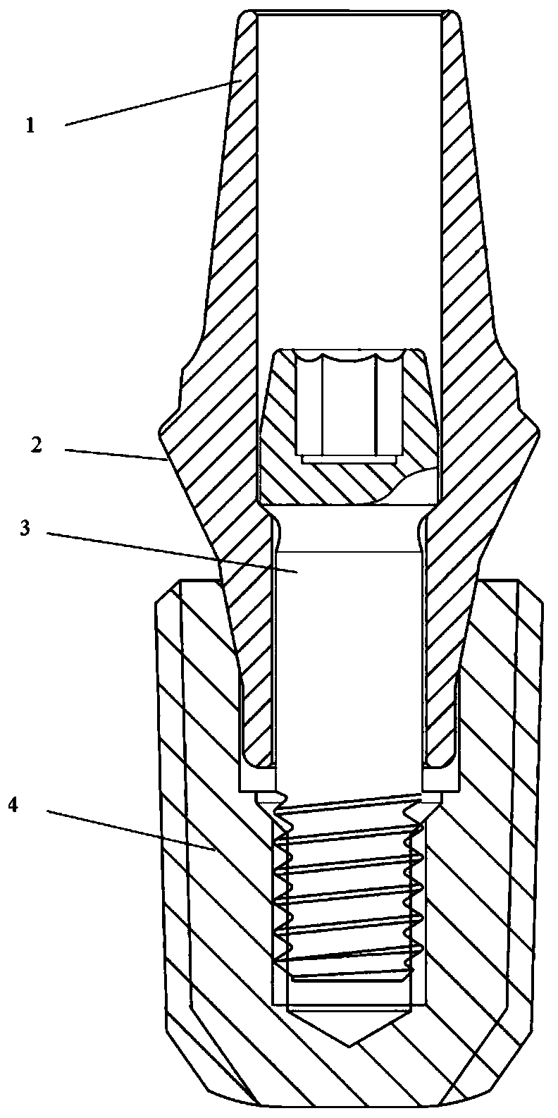 Implant tooth structure based on SLM forming and forming method thereof