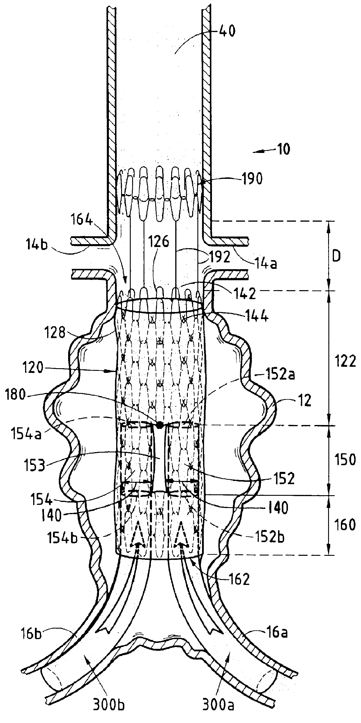 Device forming an endoluminal intracorporeal endoprosthesis, in particular for the abdominal aorta