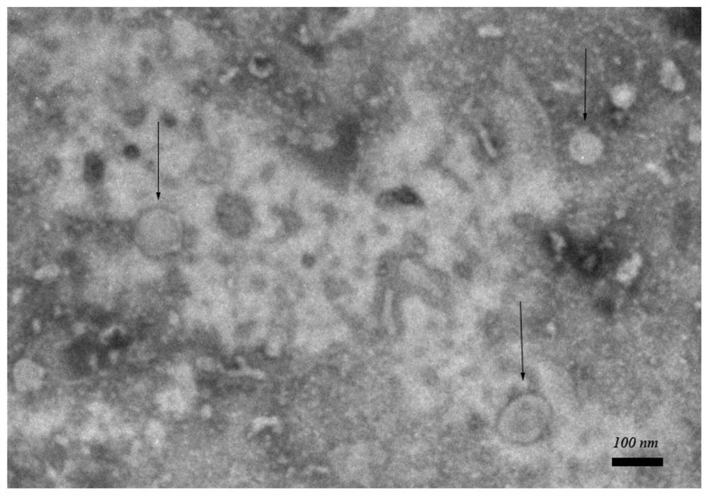 Embryo culture solution containing fallopian tube-derived exosomes and embryo culture method