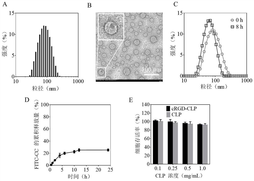 A polylipopeptide vesicle with negatively charged inner membrane and its preparation method and application