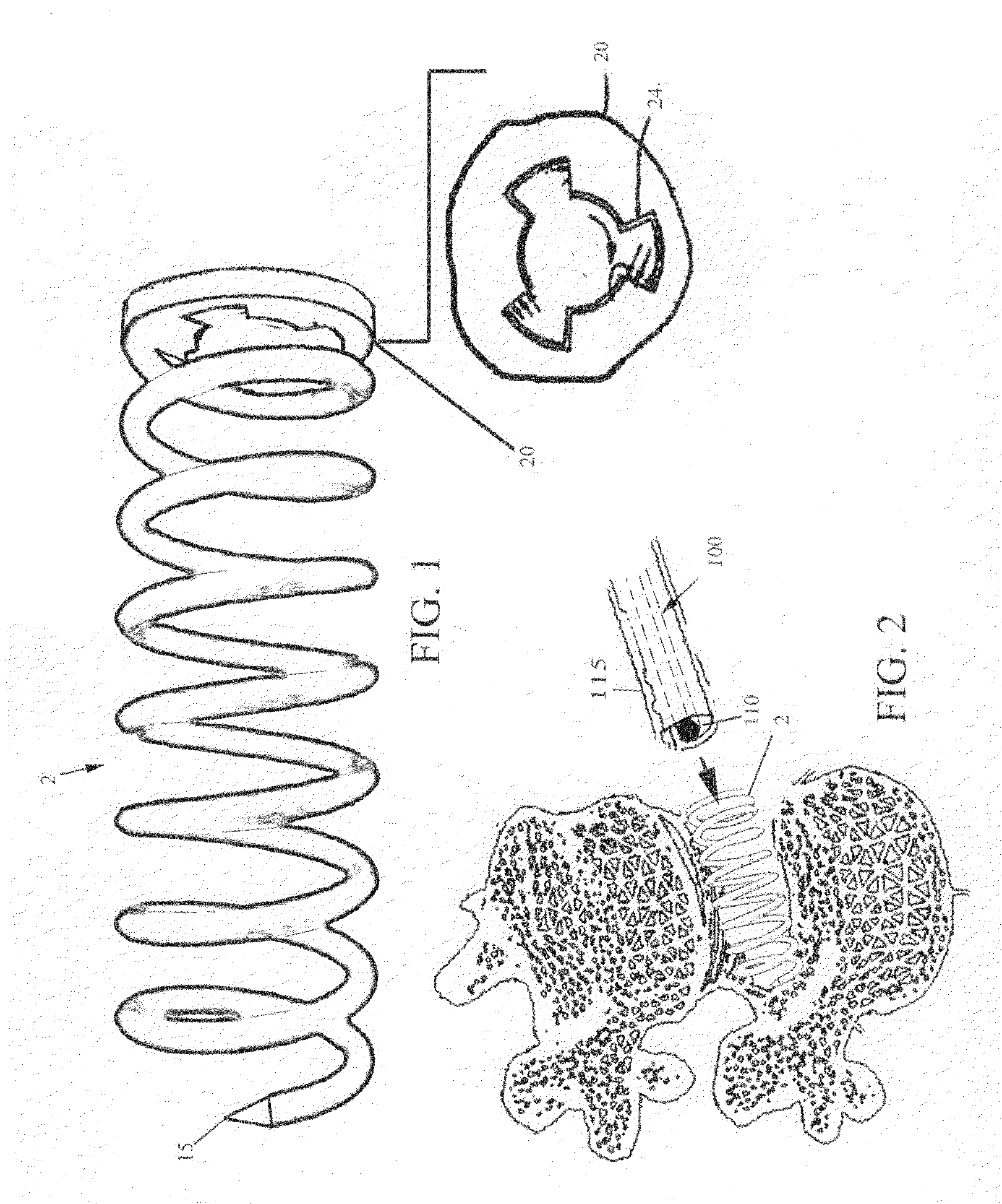 Intervertebral disc support coil and screw applicator