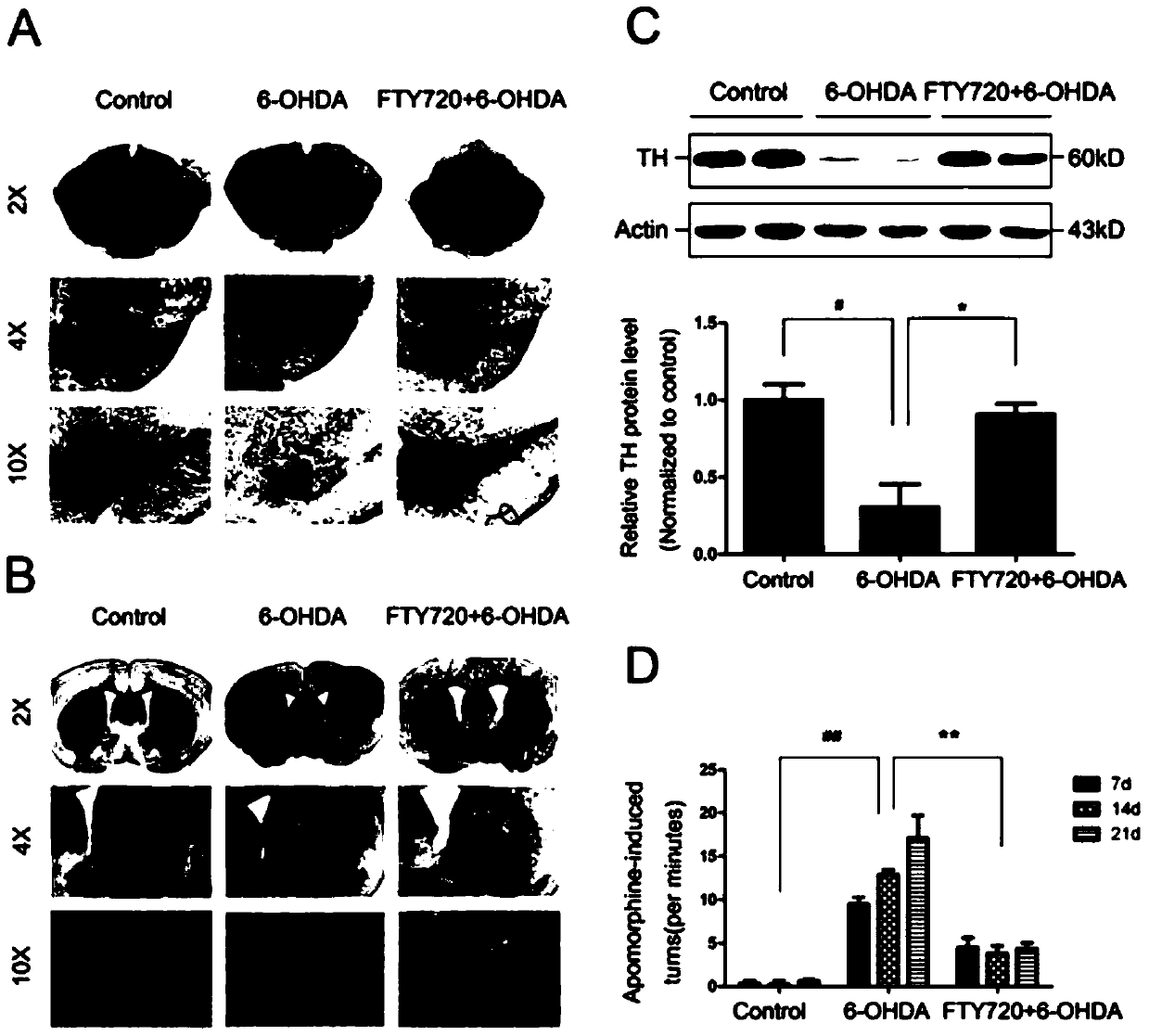 Uses of the drug fingolimod