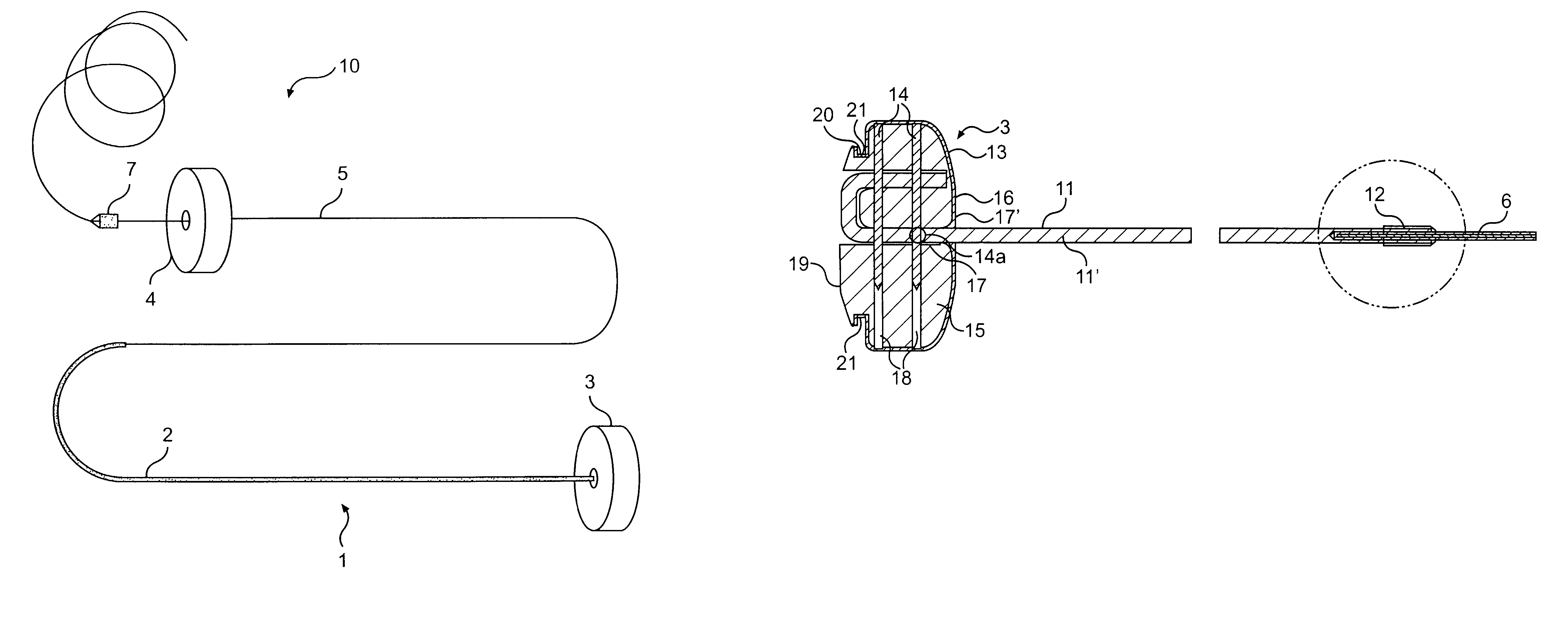 Splint assembly for improving cardiac function in hearts, and method for implanting the splint assembly