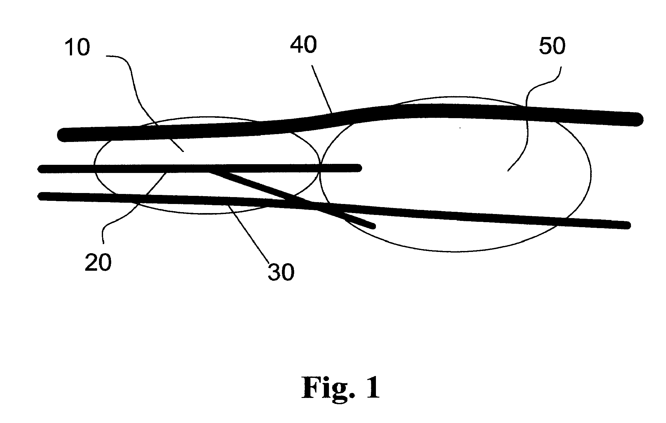 Intraoperative Tissue Mapping and Dissection Systems, Devices, Methods, and Kits