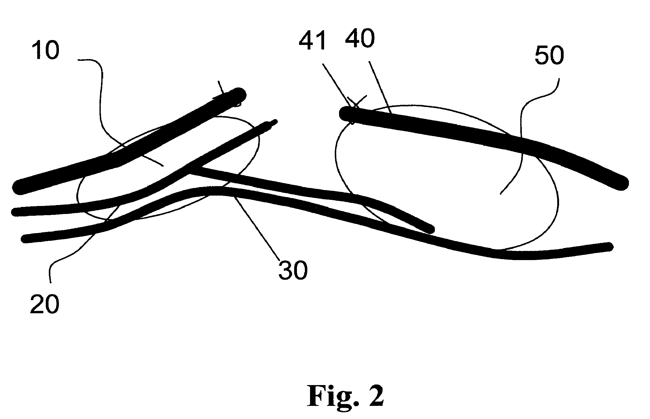 Intraoperative Tissue Mapping and Dissection Systems, Devices, Methods, and Kits