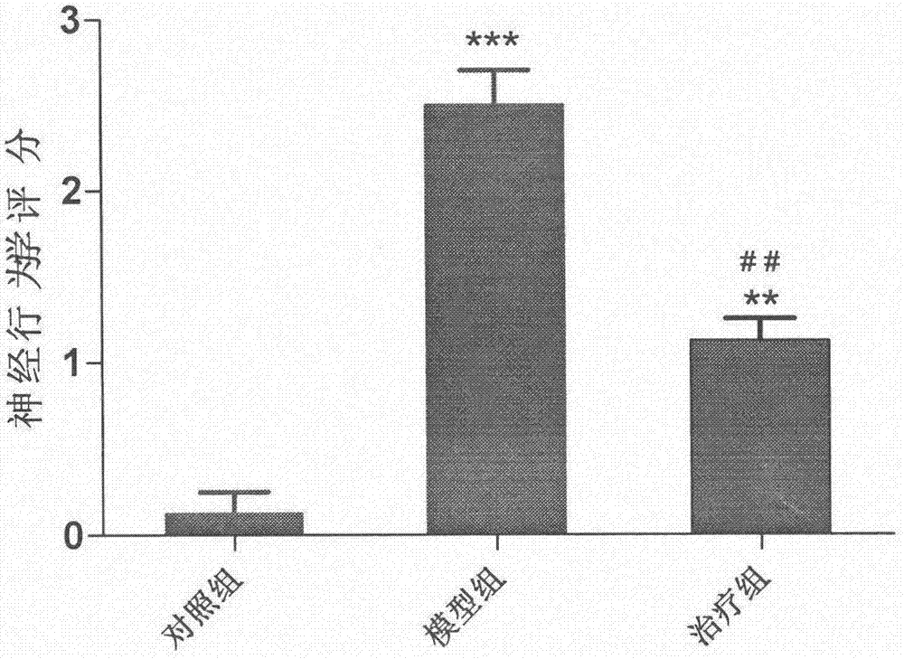 Medicine for preventing and treating brain stroke