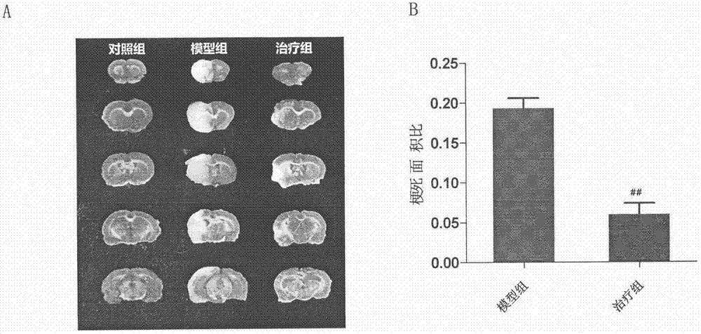 Medicine for preventing and treating brain stroke