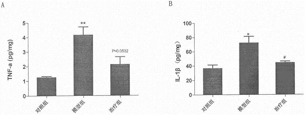 Medicine for preventing and treating brain stroke