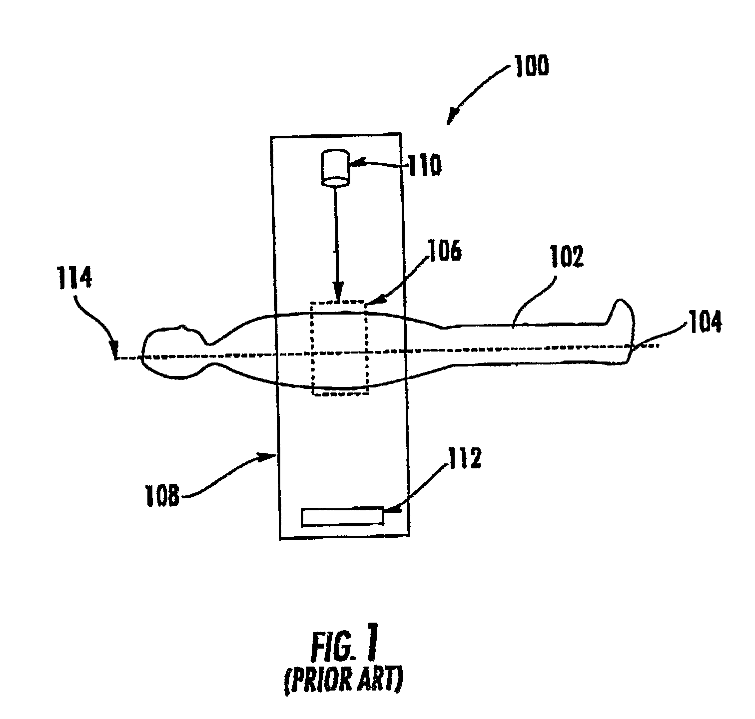 System Including Computed Tomography Device For Image Guided Treatment