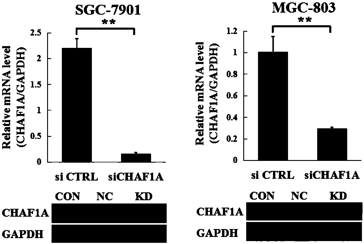 Application of CHAF1A (chromatin assembly factor 1 subunit A) inhibitor in gastric cancer therapeutic medicine preparation