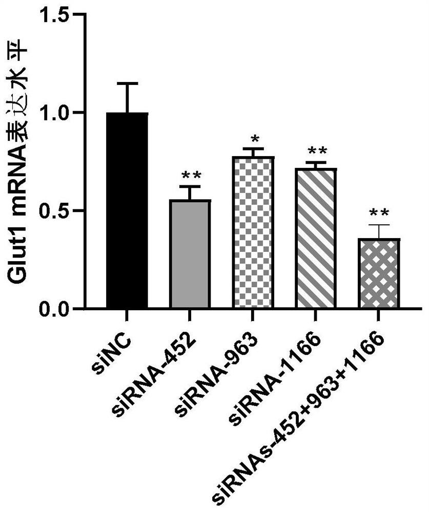 RNAi adeno-associated virus for inhibiting Slc2a1 as well as preparation and application of RNAi adeno-associated virus