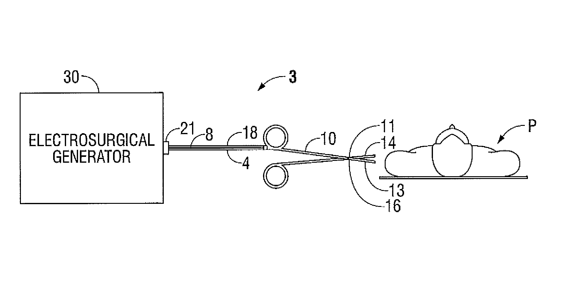 Apparatus and method for optimal tissue separation