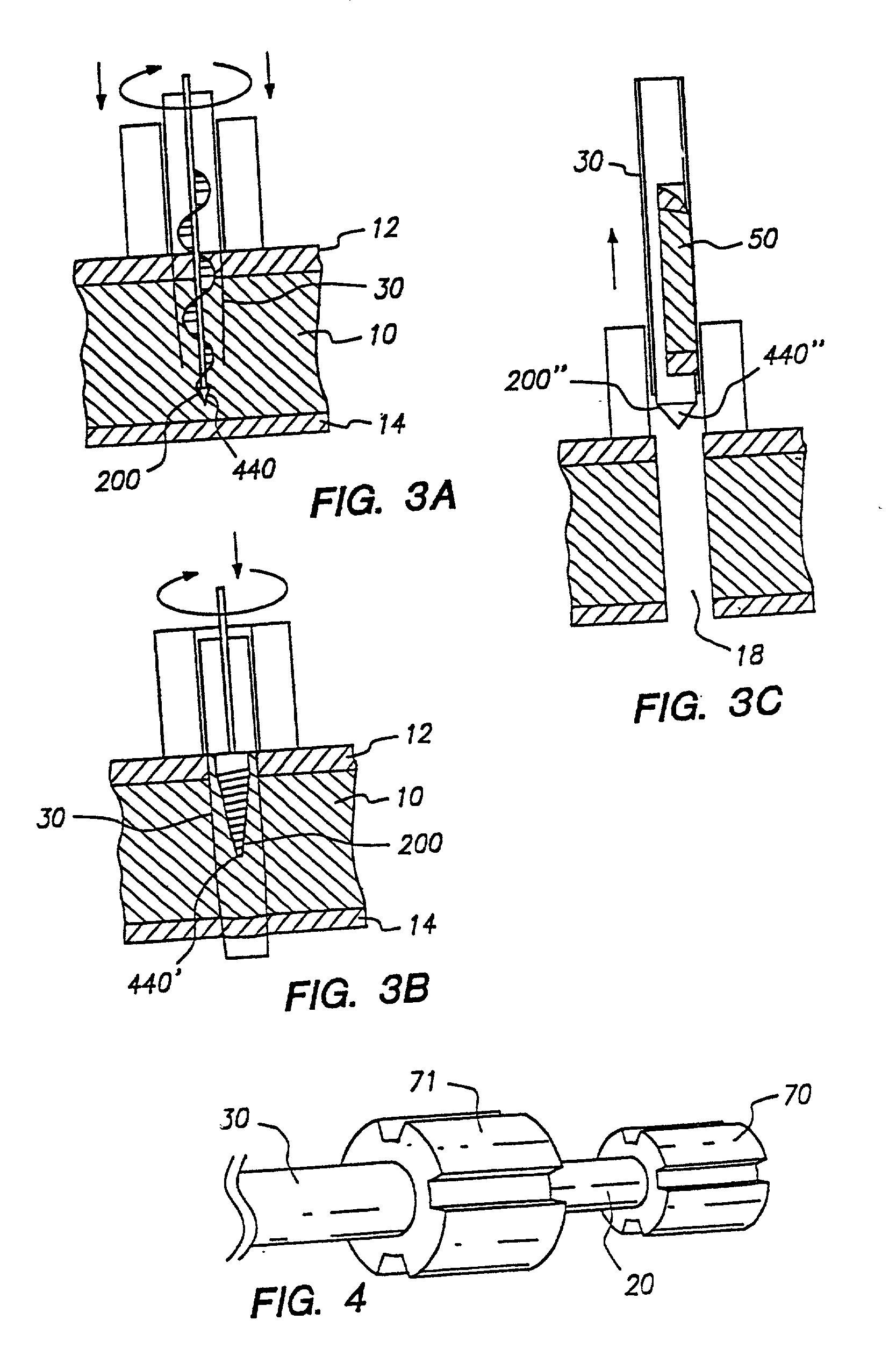 Method and apparatus for mechanical transmyocardial revascularization of the heart